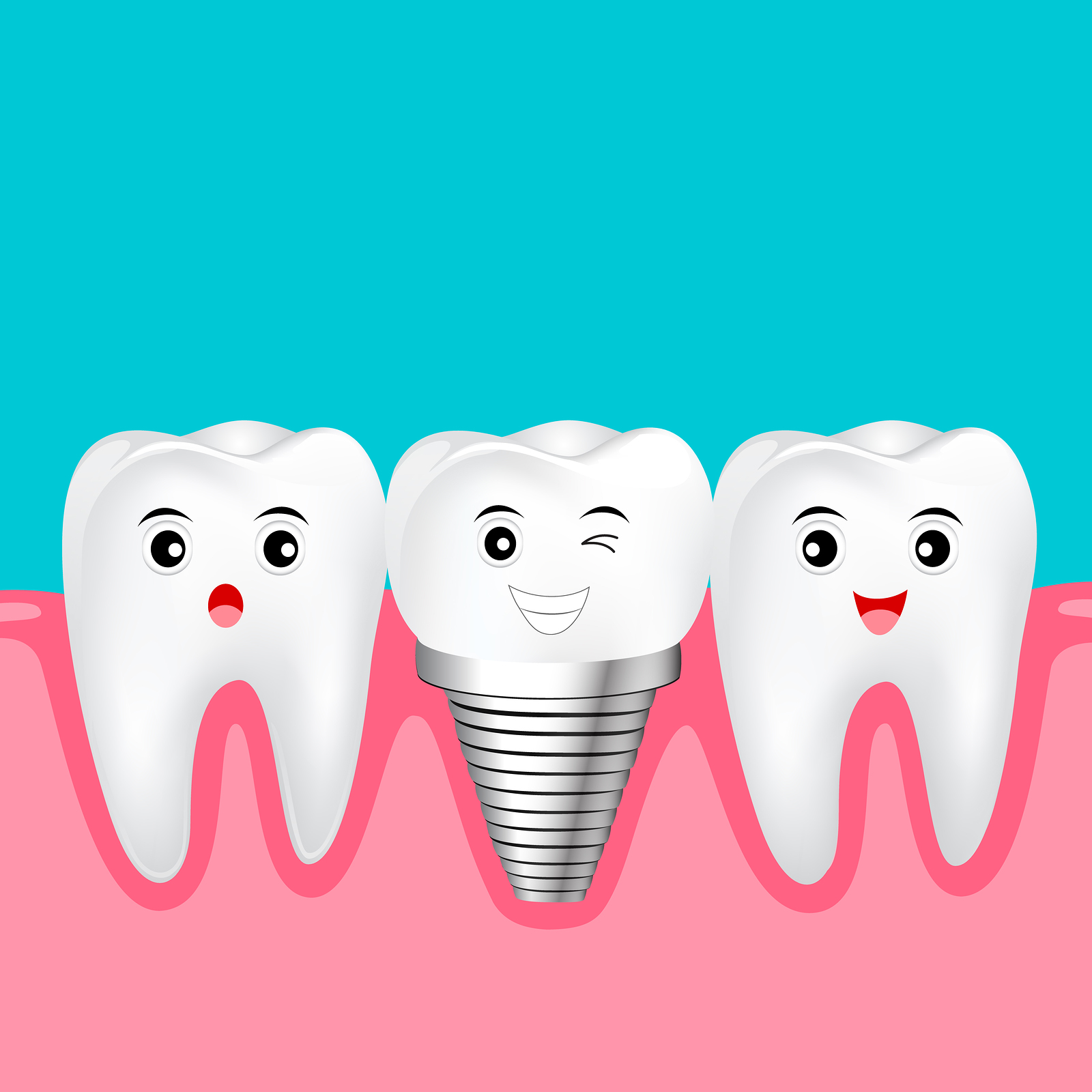 Why are dental implants more conservative than bridges?