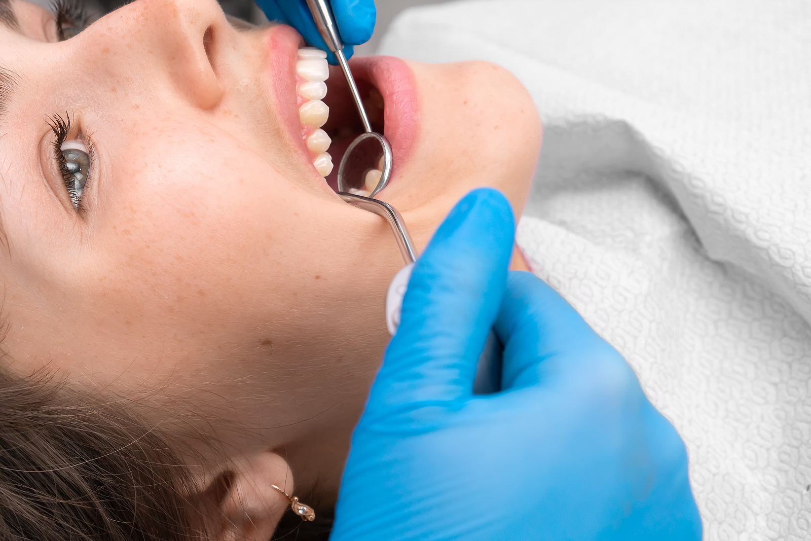 What To Expect at Your Next Dental Exam