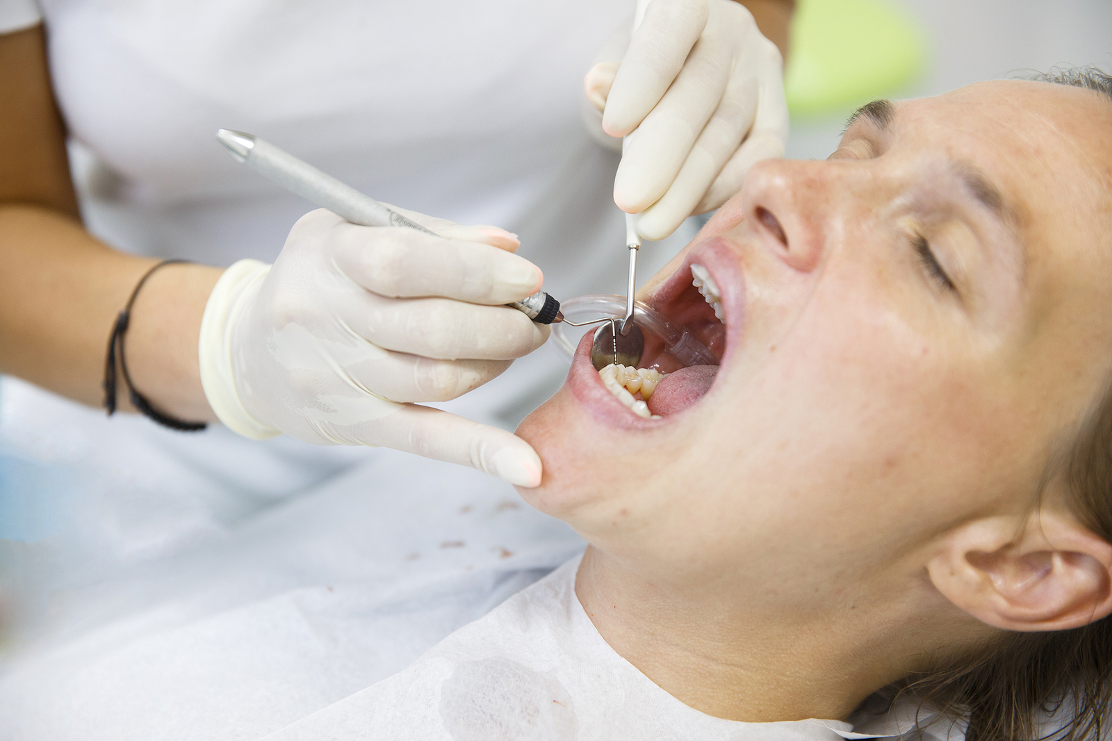 Top Aftercare Tips to Ensure a Smooth Recovery After Root Canal Treatment